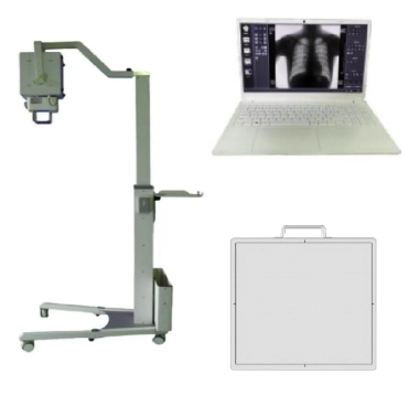 QMDR-50/53/56/80 Mobile Digital Radiography X-ray System