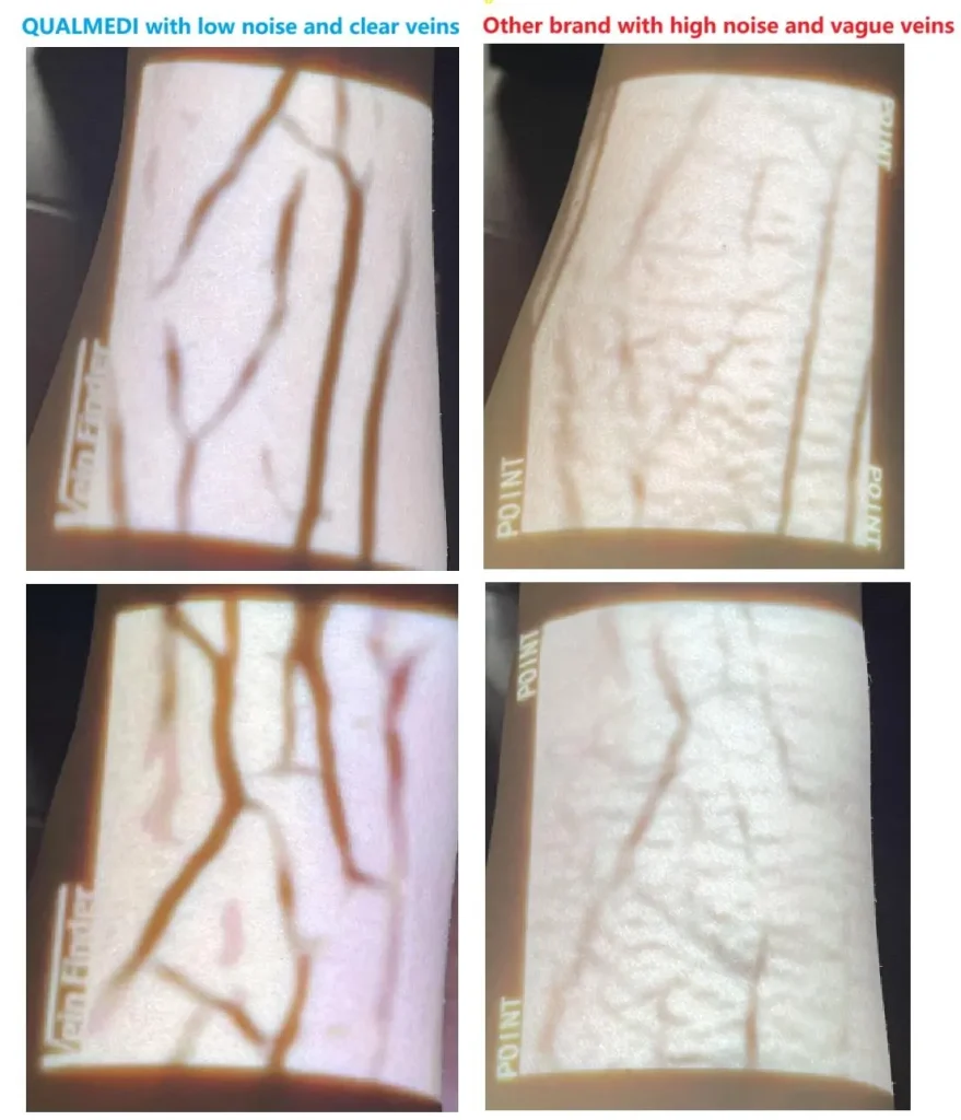 Comparación de imágenes de Vein Finder
