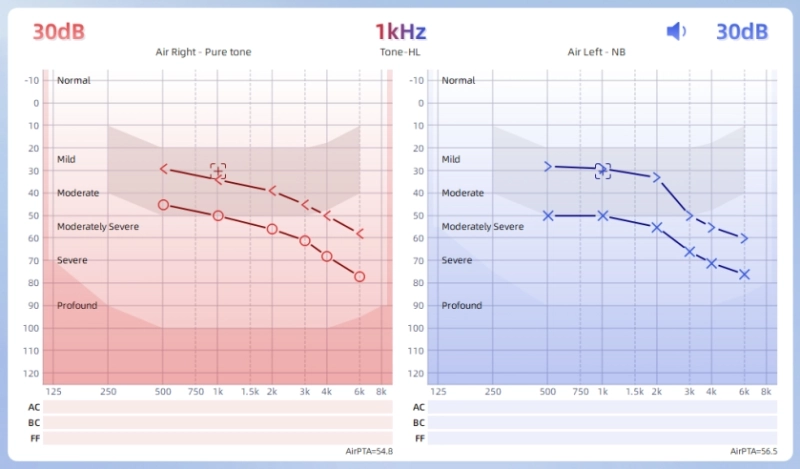 QA700 Clinical Audiometer Data Chart